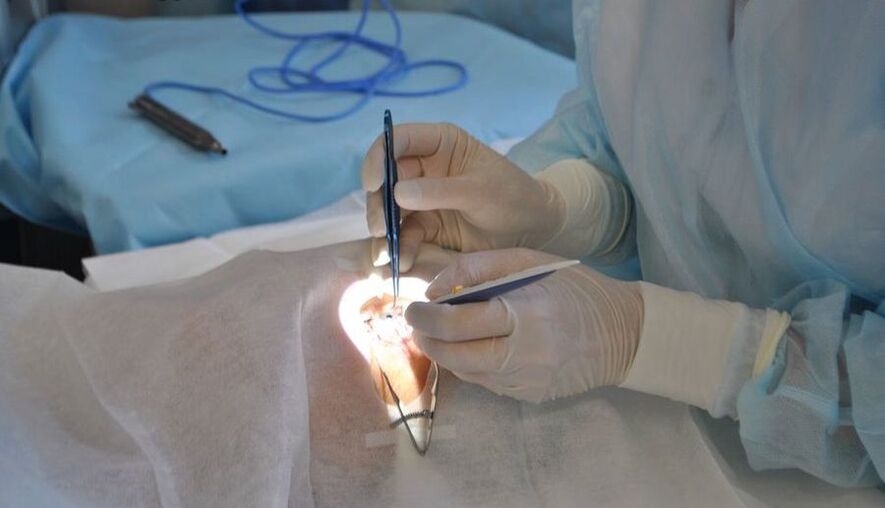 Eye surgery to help restore vision